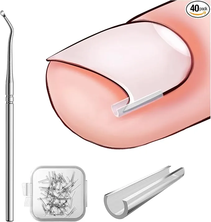 BEZOX – Kit Correcteur d’Ongles Incarnés