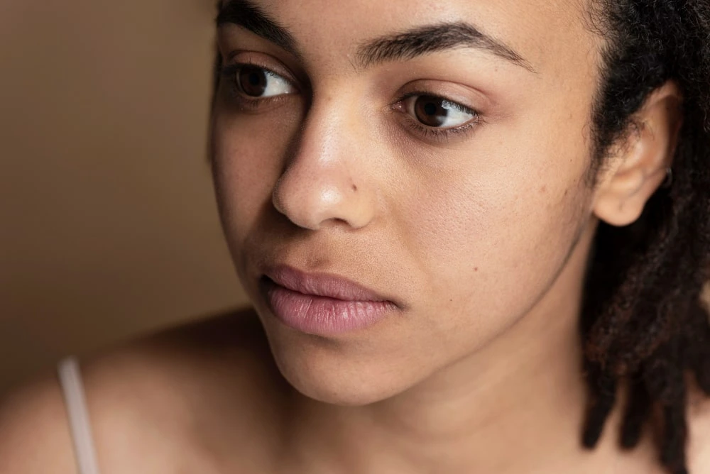 Comment Gérer l&rsquo;Hyperpigmentation sur Peau Noire et Métisse