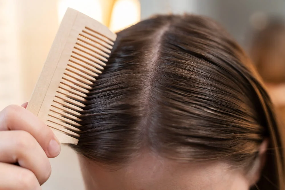 Le Scalp Care pour stopper la chute